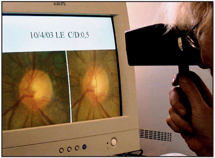 ScreenVu Original