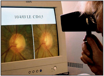 ScreenVu Original
